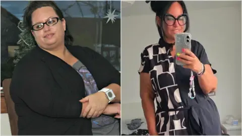 Many Shed Weight With Jabs – Then Came the Sagging Skin
